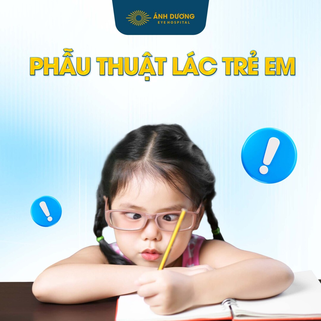 Phẫu thuật lác trẻ em – Giải pháp giúp trẻ lấy lại đôi mắt sáng trong và tương lai tươi sáng