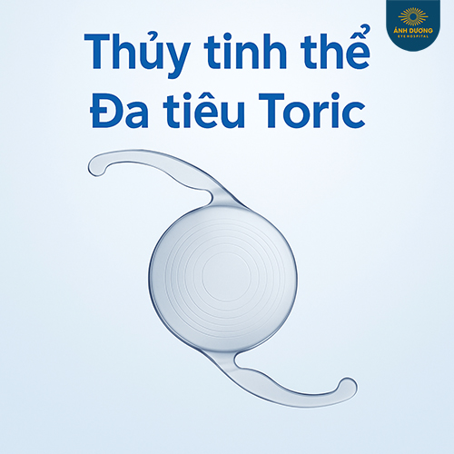 Phẫu Thuật Thay Thể Thủy Tinh đa Tiêu Toric