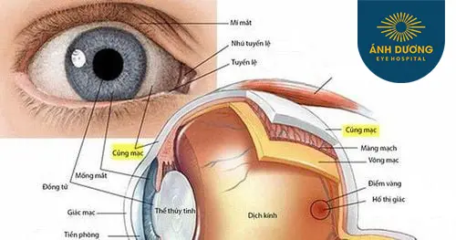 Cắt củng mạc sâu – Phương pháp điều trị tăng nhãn áp an toàn và hiệu quả