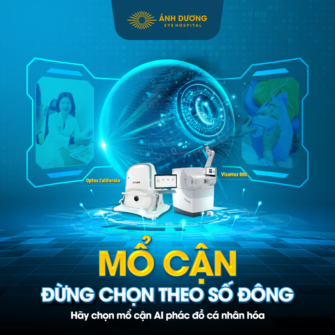 Ưu điểm mổ cận AI – Đột phá công nghệ giúp xóa cận an toàn, chính xác