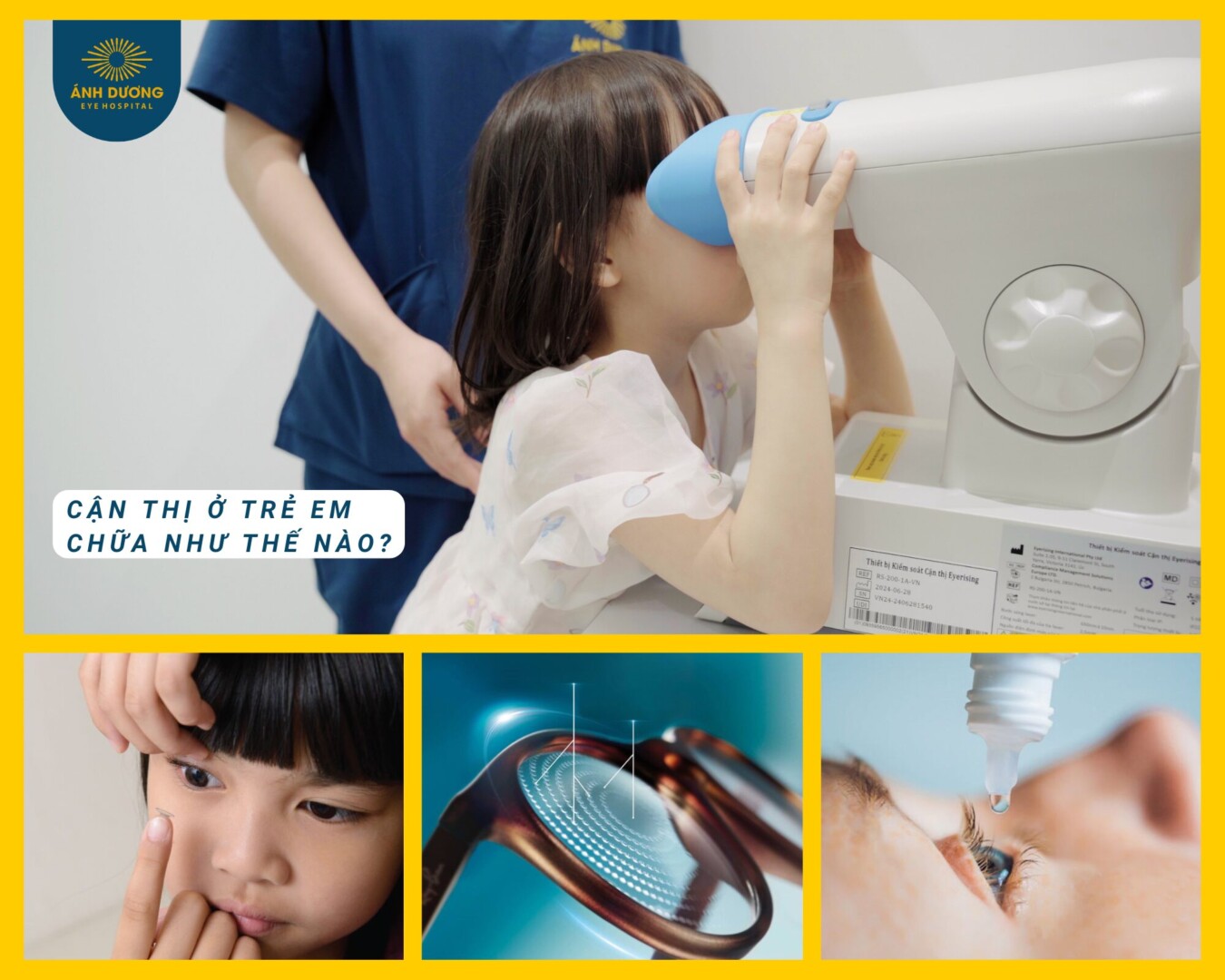 Cận Thị ở Trẻ Em Chữa Như Thế Nào