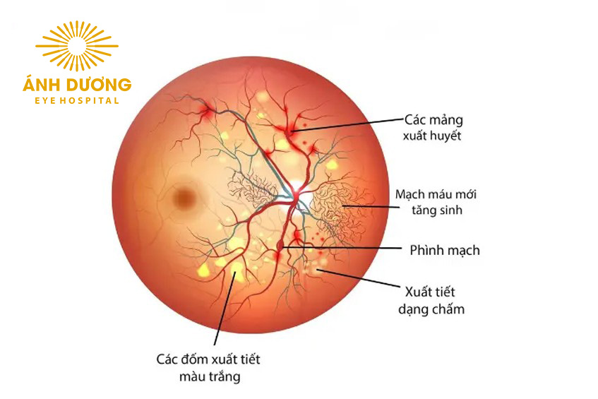 Tang Sinh Dich Kinh Vong Mac