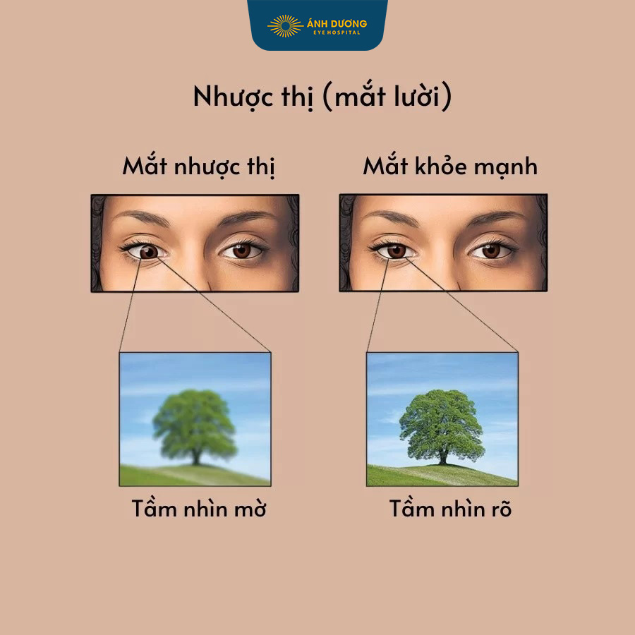 NHƯỢC THỊ – NHỮNG THÔNG TIN CÓ THỂ BẠN CHƯA BIẾT