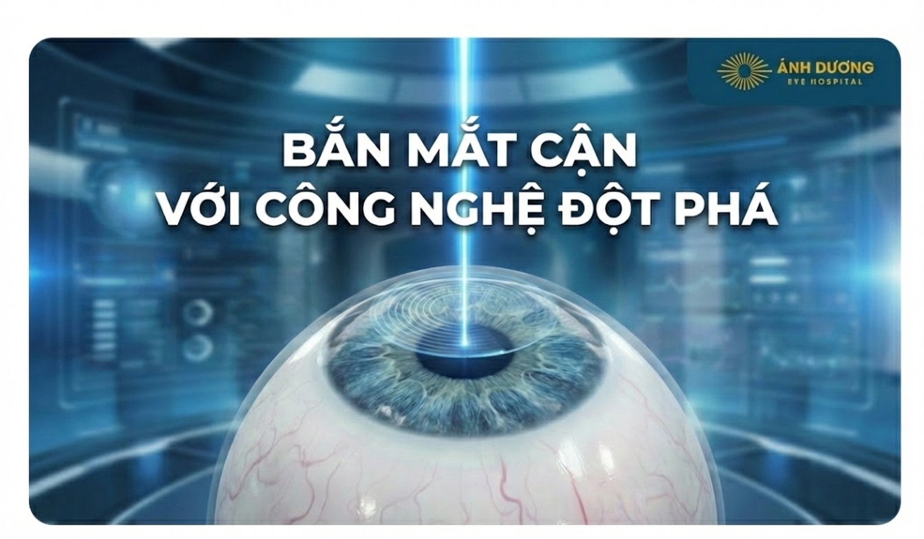 Bắn Mắt Cận Công Nghệ Cao: Đột Phá Với Smile Pro AI, Smart Surf Và Phakic Tại Ánh Dương