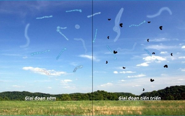 Ruồi bay trước mắt là gì? Nguyên nhân và dấu hiệu cảnh báo nguy hiểm