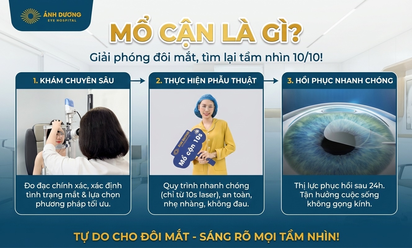 Mổ Cận Là Gì? Review Chi Tiết 5 Công Nghệ Xóa Cận Đỉnh Cao Tại Mắt Ánh Dương