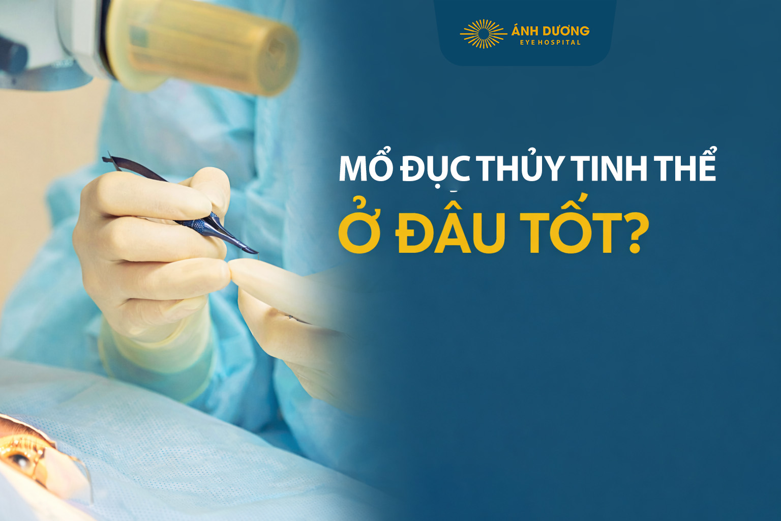 Mổ Đục Thủy Tinh Thể Ở Đâu Tốt? Chọn Mắt Ánh Dương – Uy Tín, Áp Dụng BHYT Tối Đa