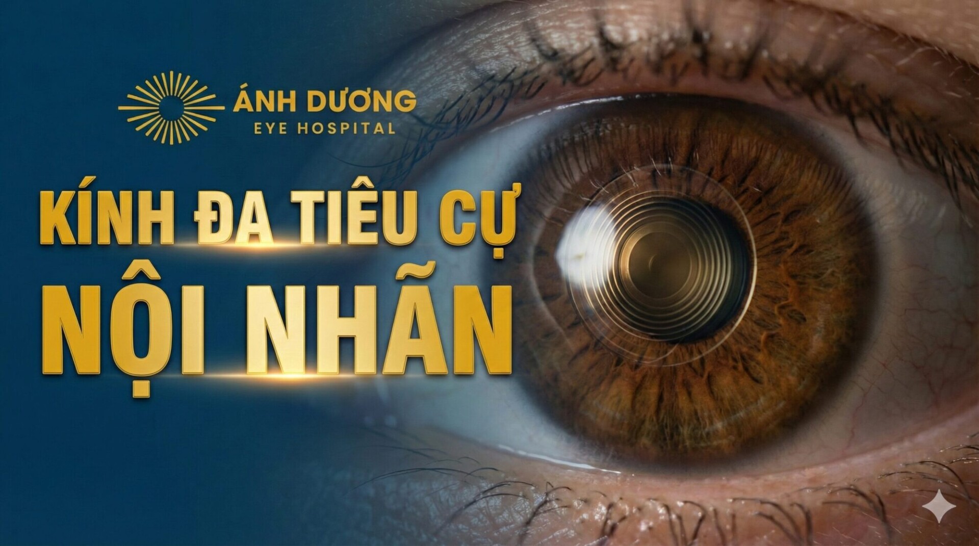 Kính đa tiêu cự nội nhãn – Giải pháp giúp người trung niên, cao tuổi nhìn rõ ở mọi khoảng cách