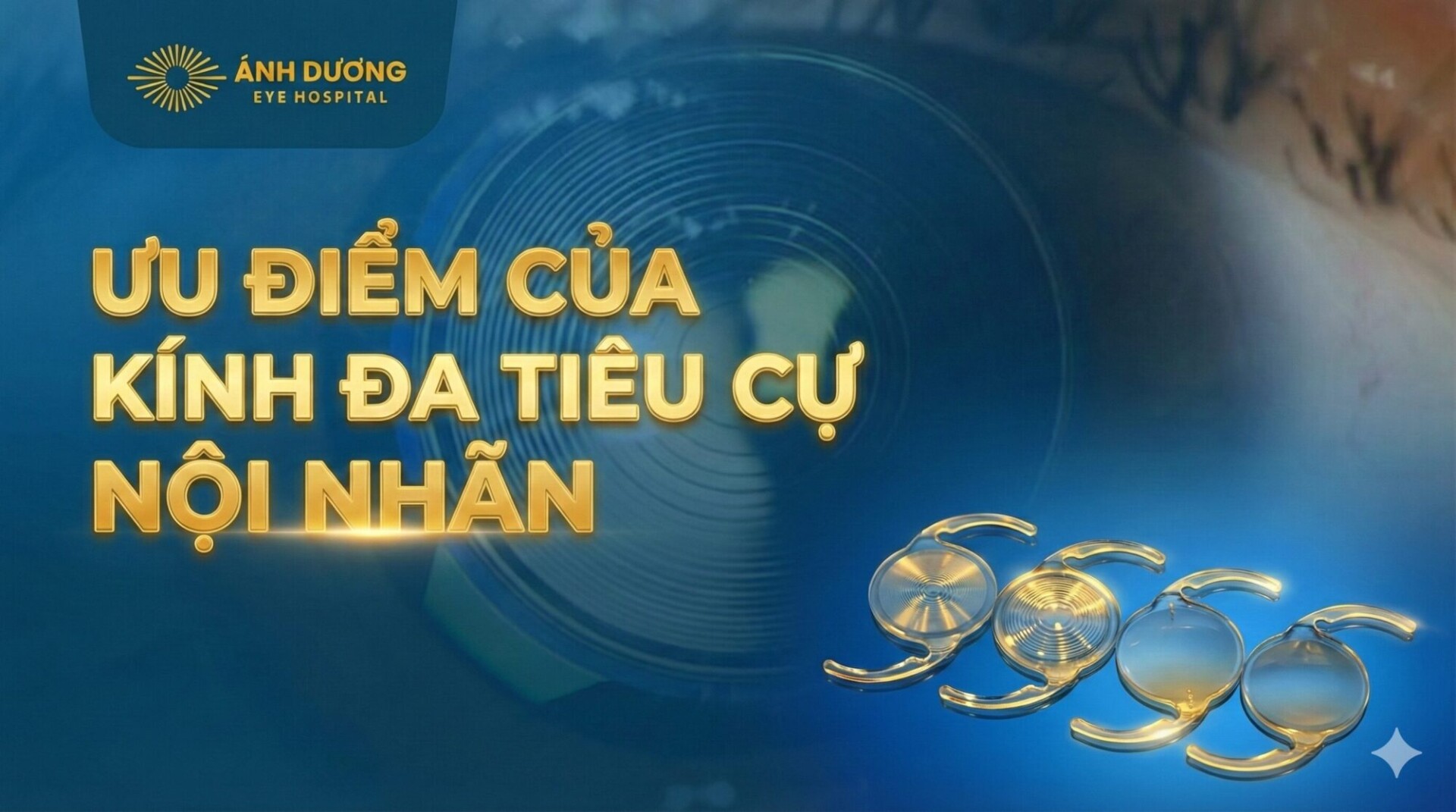 Ưu điểm kính đa tiêu cự nội nhãn – Giải pháp giúp nhìn rõ ở mọi khoảng cách sau phẫu thuật thủy tinh thể